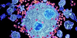 More Than 3,000 New Jersey Patients Could Have HIV More Than 3000 New Jersey