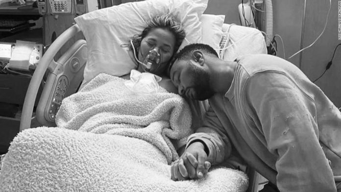 Chrissy Teigen Suffers Miscarriage