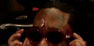 Lil Uzi Spent 4 Years Paying For $24 Mil Forehead Diamond Implant forehead diamond implant