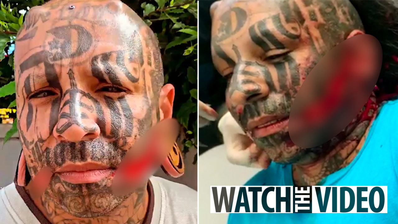 A Brazilian Rapper Rips His Face To Achieve “Demon Smile”