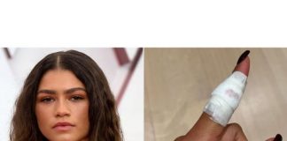 Zendaya Cuts Her Finger While Cooking ZENDAYA CUTS OFF HER FINGER