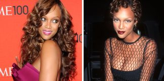 10 Celebrities Who Are Proud of Their Plastic Surgery Celebrity embracing plastic surgery enhancements