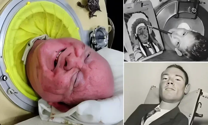 Paul Alexander iron lung death