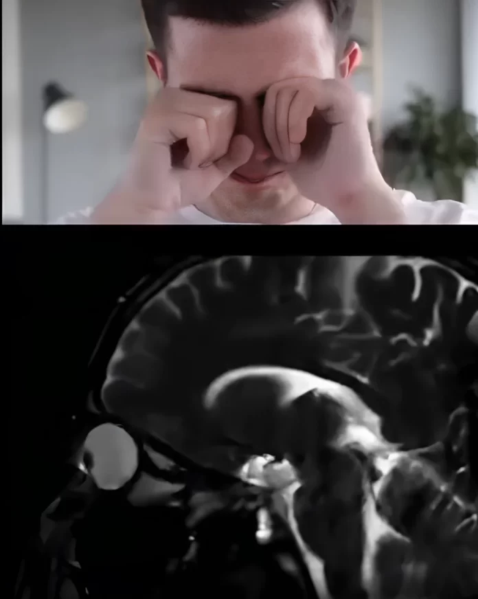 MRI scan eye rubbing visualization