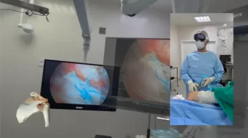 Apple Vision Pro surgical technology