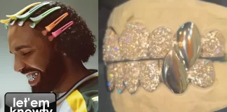 Drake’s New Diamond Grillz From Johnny Dang Are Lit Drake's New Diamond Grillz