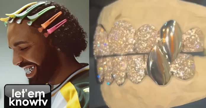 Drake's New Diamond Grillz