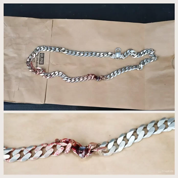 Colorado man saved by metal chain