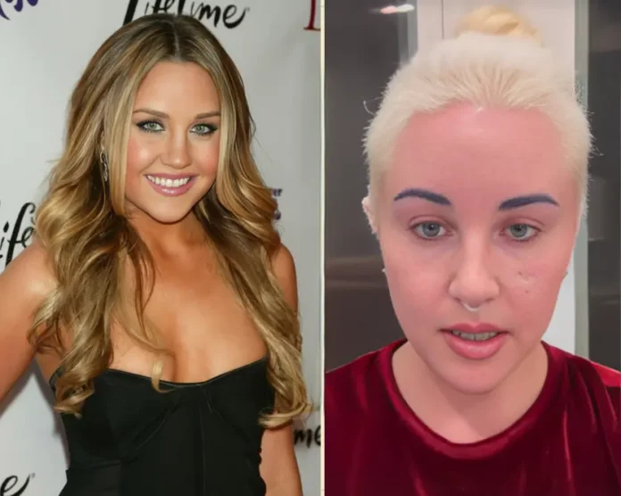 Amanda Bynes appearance transformation news