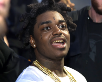 Kodak black remove 24 of his gold teeth