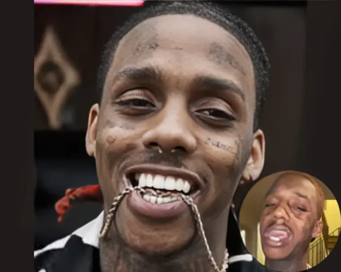 Chicago rapper Famous Dex on missing bottom teeth