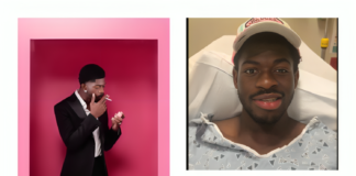 What Happened to Lil Nas X? He Says Half His Face Stopped Working lil nas x facial paralysis news