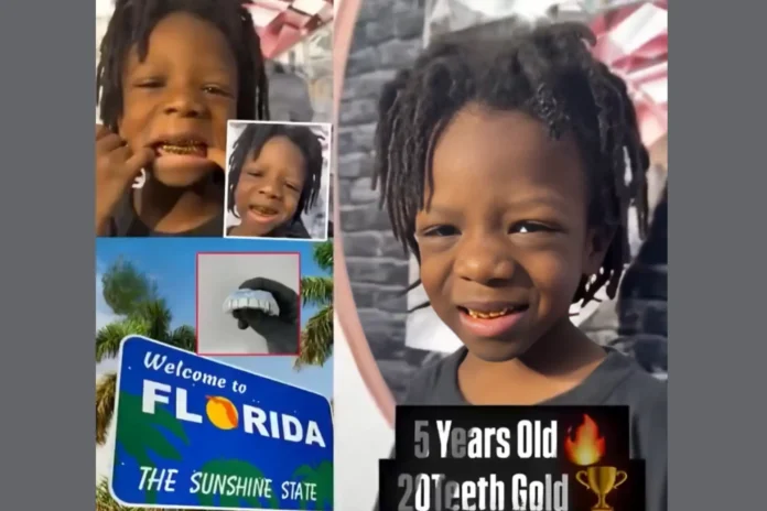 florida parents buy son gold grillz for birthday