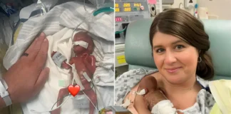 Miracle Baby Born at 21 Weeks Defies All Odds to Celebrate First Birthday world’s most premature baby 2025