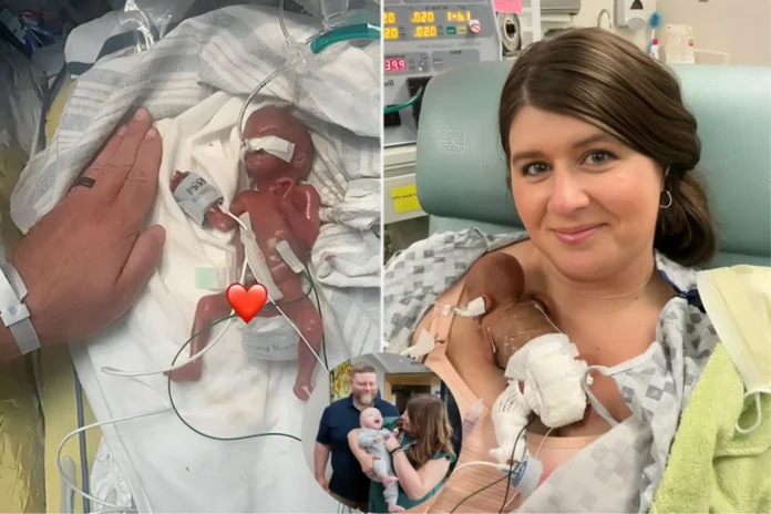 world’s most premature baby 2025