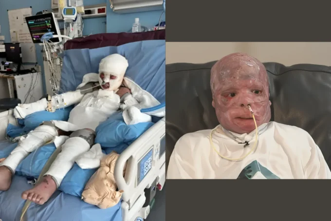 Ramesses Vazquez Viana: 9-Year-Old’s Incredible Fight Continues