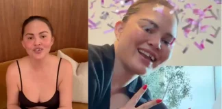 Chrissy Teigen Shares Dental Mishap After Losing Tooth to Candy Cane Chrissy Teigen lost tooth