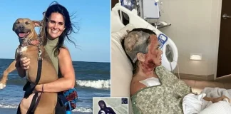 Savannah Acid Attack: Woman Critically Burned in Random Forsyth Park Chemical Assault Savannah acid attack