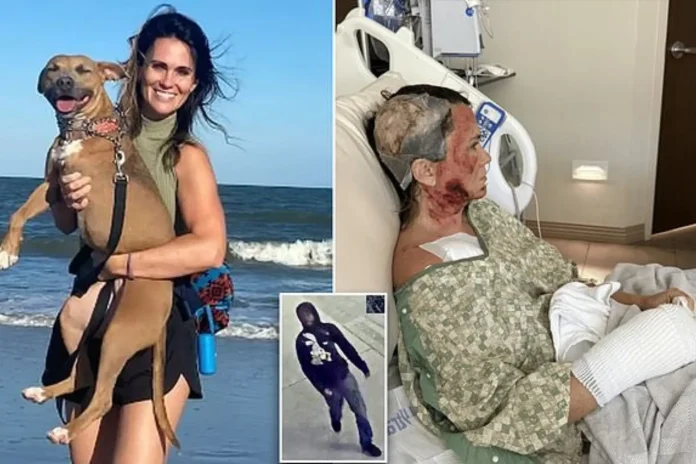 Savannah acid attack