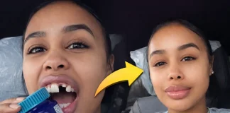 DreamDoll Shatters Tooth Opening Vicks VapoRub in Viral Video DreamDoll shattered tooth Vicks VapoRub