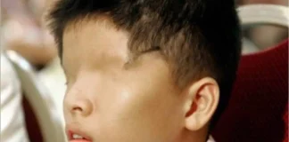 The Tragic Story of Le Van O: Born Without Eyes Due to Agent Orange Le Van O Agent Orange