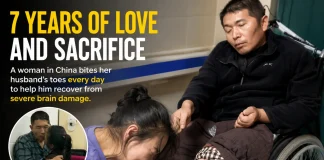 Woman Bites Husband’s Toes Daily for 7 Years to Reverse Severe Brain Damage After Heroic Toddler Rescue reverse brain damage biting toes