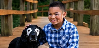 8-Year-Old Boy with Vitiligo Meets Dog with Same Condition in Heartwarming Encounter Carter Blanchard vitiligo dog