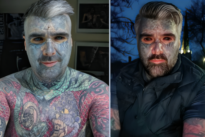 tattoo eyeball blindness