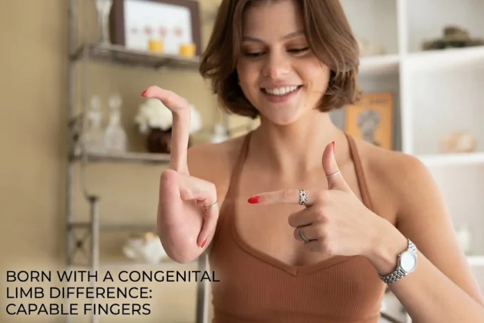 limb difference girl fingers