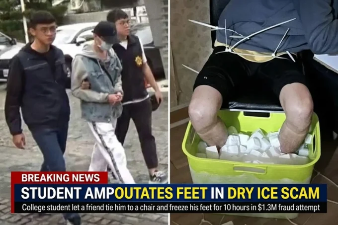College Student Endures 10 Hours of Freezing for Leg Amputation in $1.3M Insurance Scam